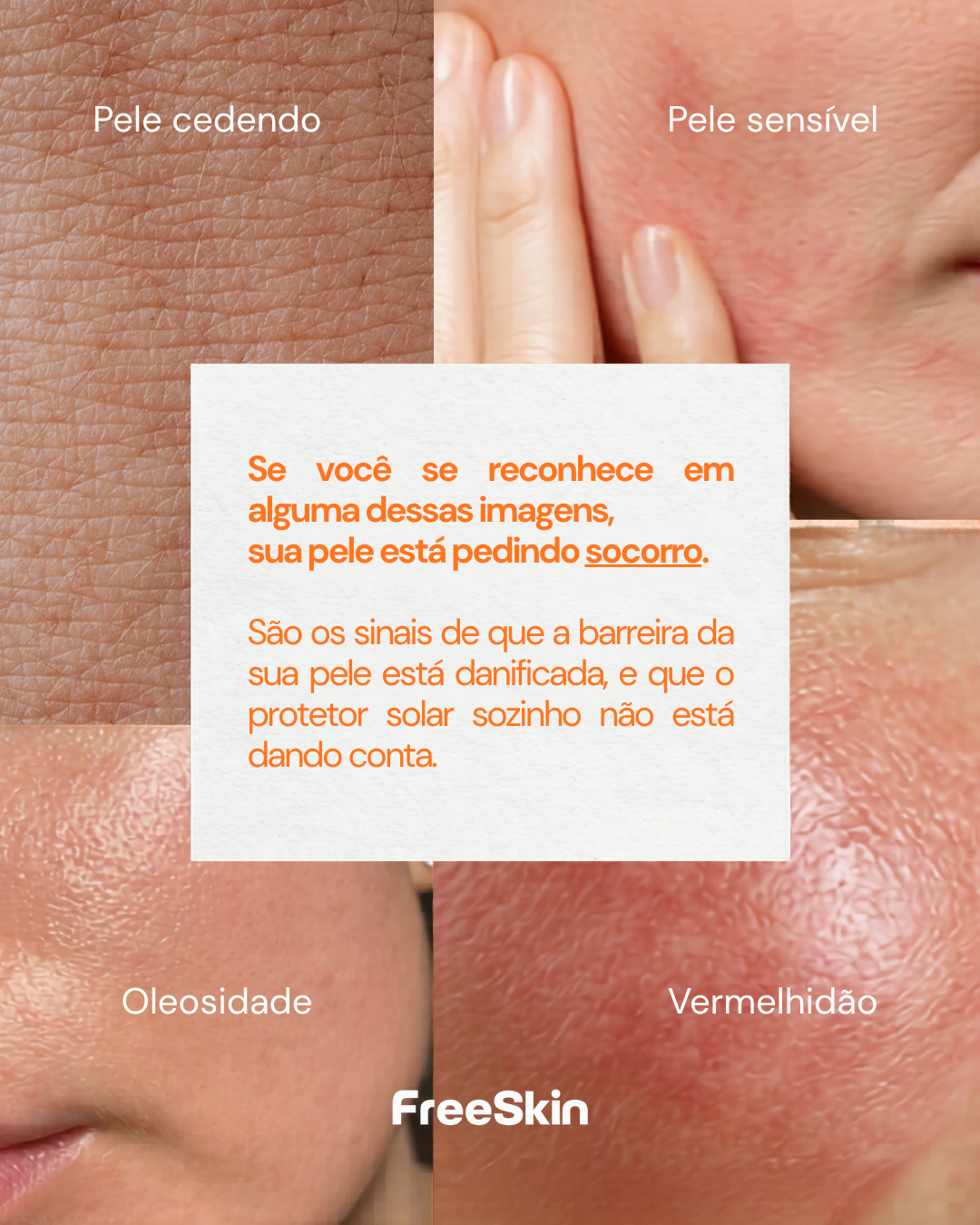 Hidratante Facial FreeSkin com TBR-3™