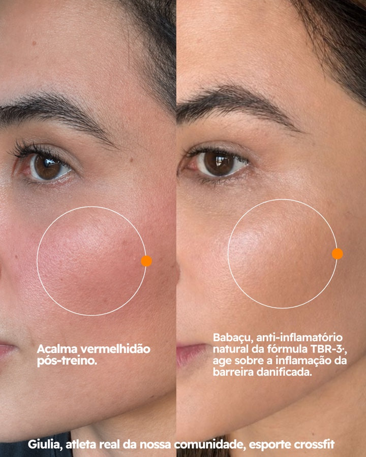 Hidratante Facial FreeSkin com TBR-3™