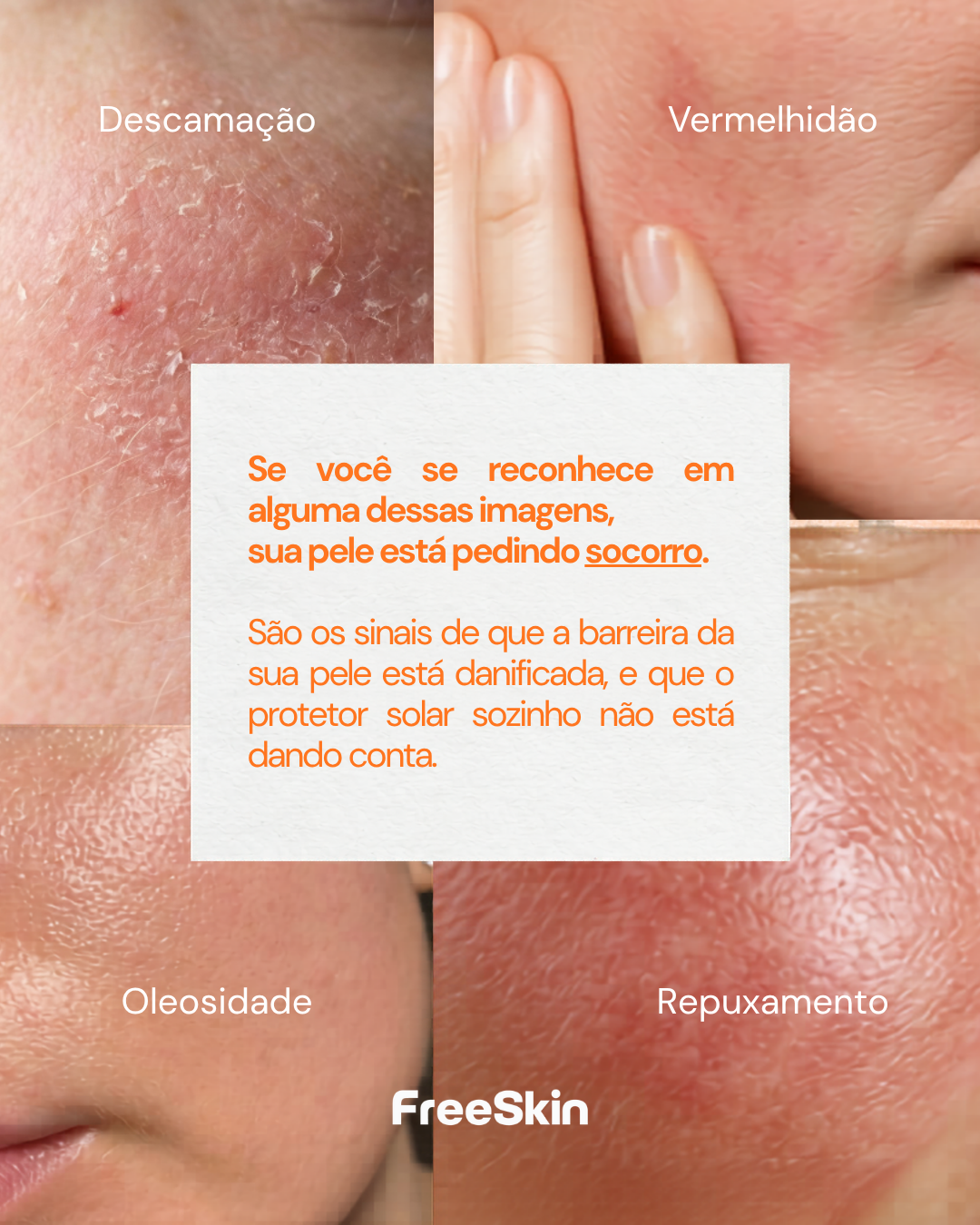 Hidratante Facial FreeSkin com TBR-3™