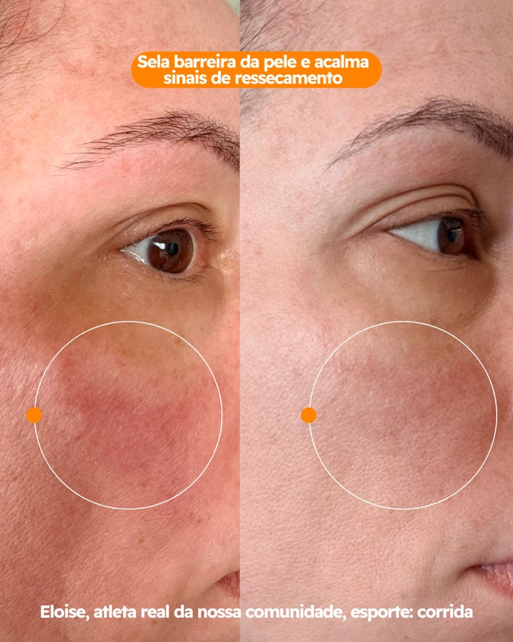 Hidratante Facial FreeSkin com TBR-3™