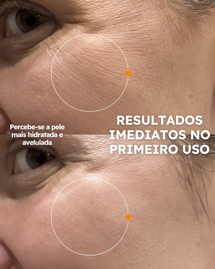 Hidratante Facial FreeSkin com TBR-3™