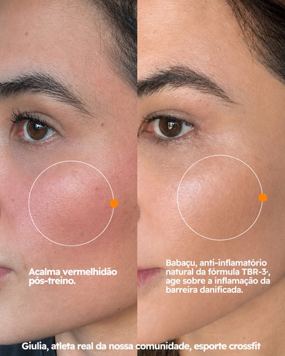 Hidratante Facial FreeSkin com TBR-3™